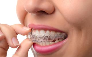 Invisalign